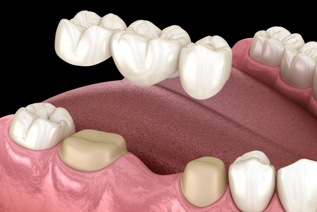 Northlake TX Dentist