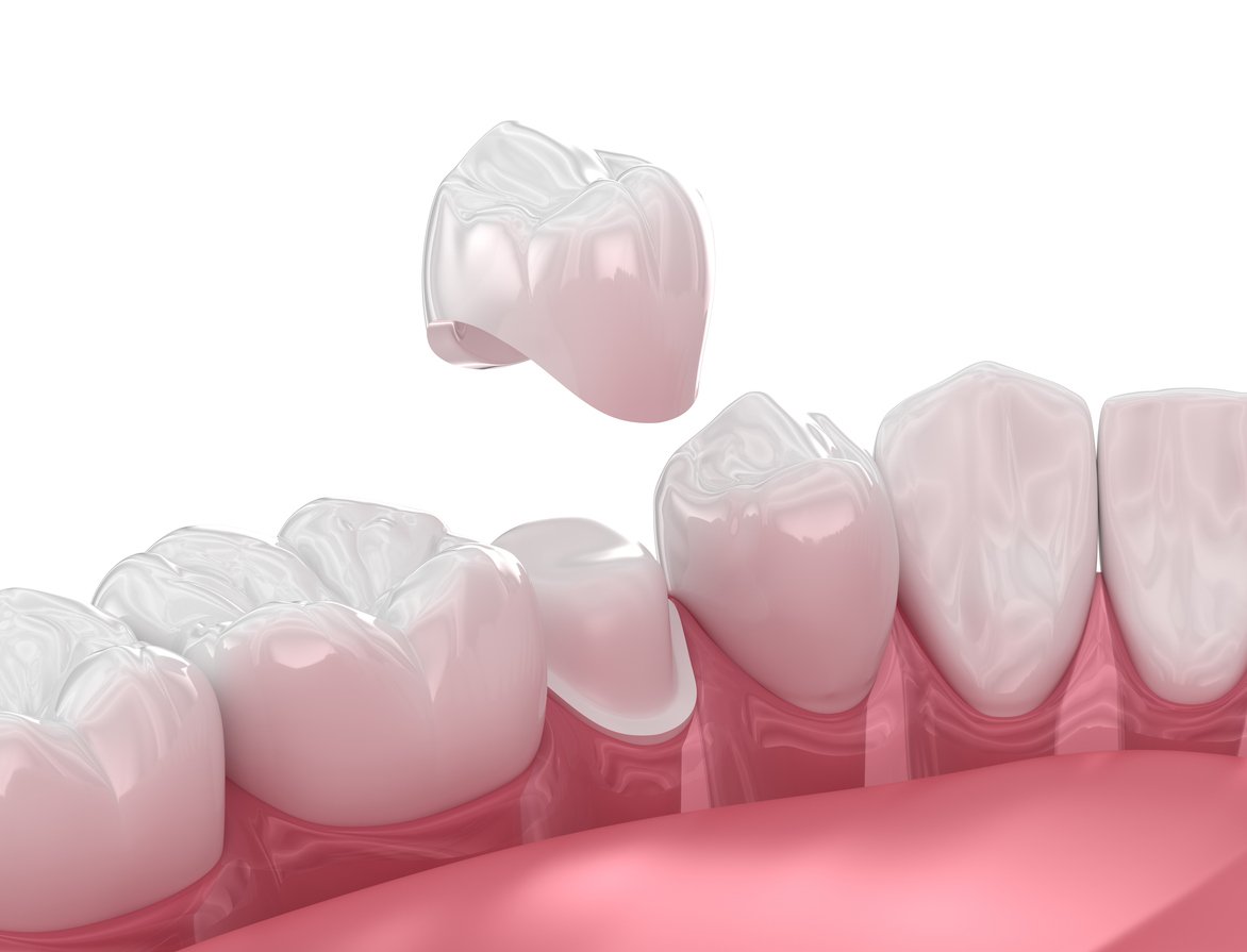 Best Dentist Northlake