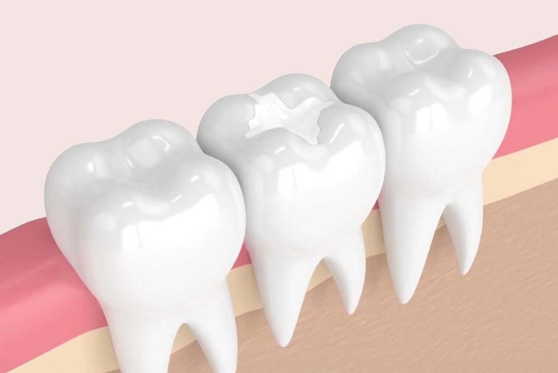 Northlake Dentist